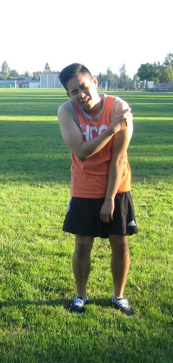 Am I allergic to cocoa butter lotions?